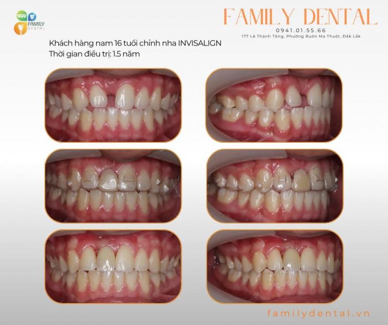 Family Dental - Nha khoa Family