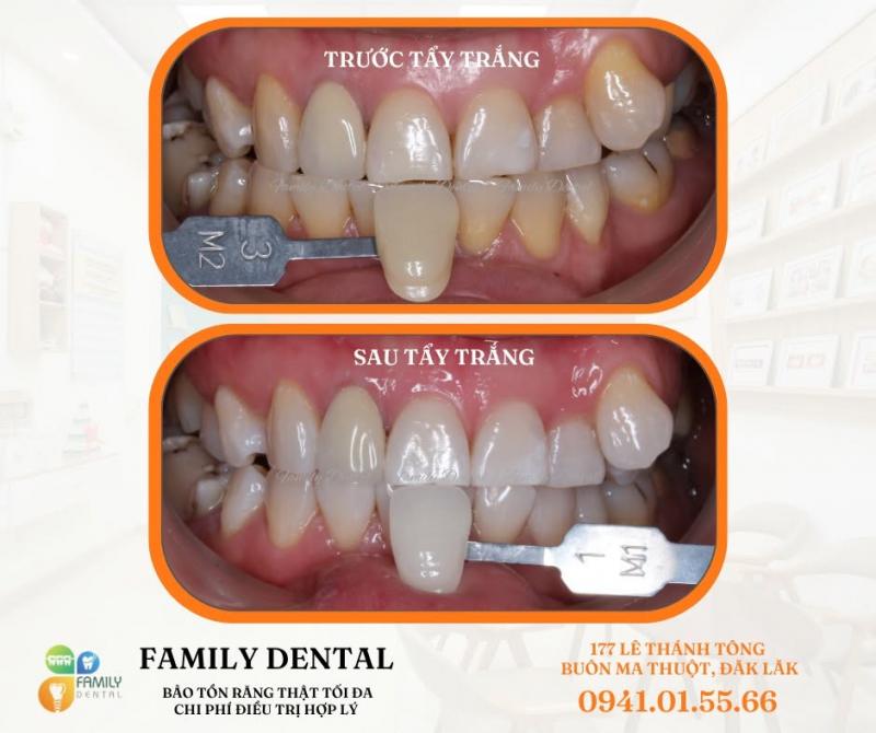 Family Dental - Nha khoa Family