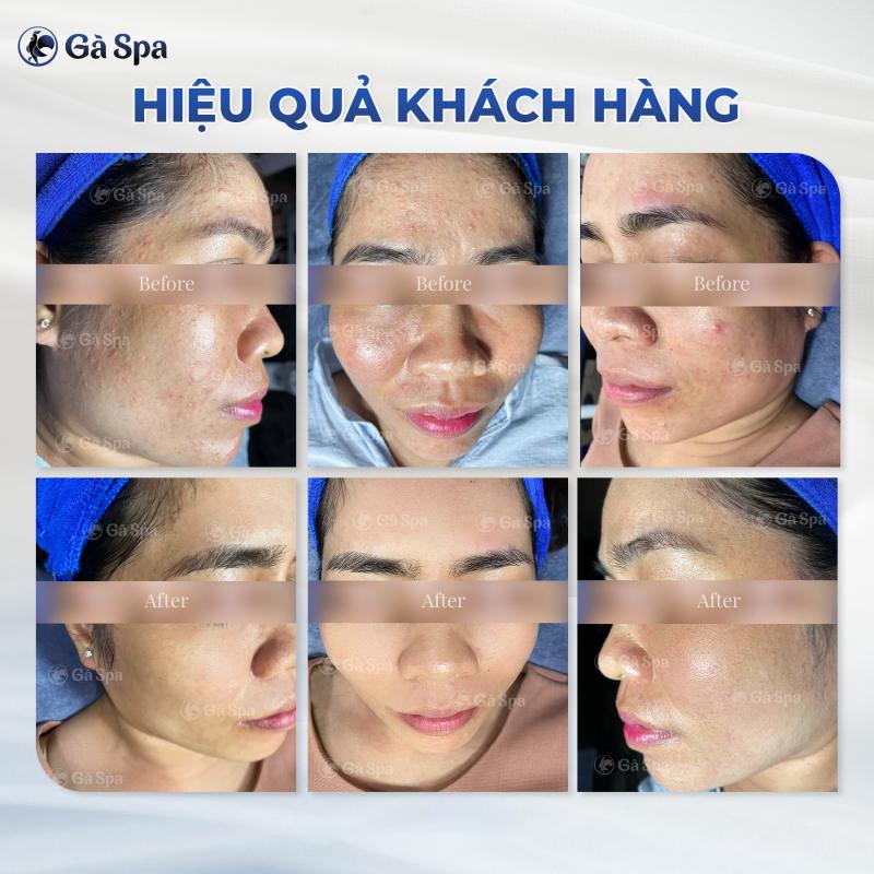 Gà Spa Quận 12