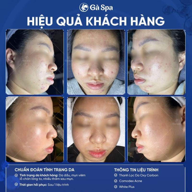 Gà Spa Đà Nẵng