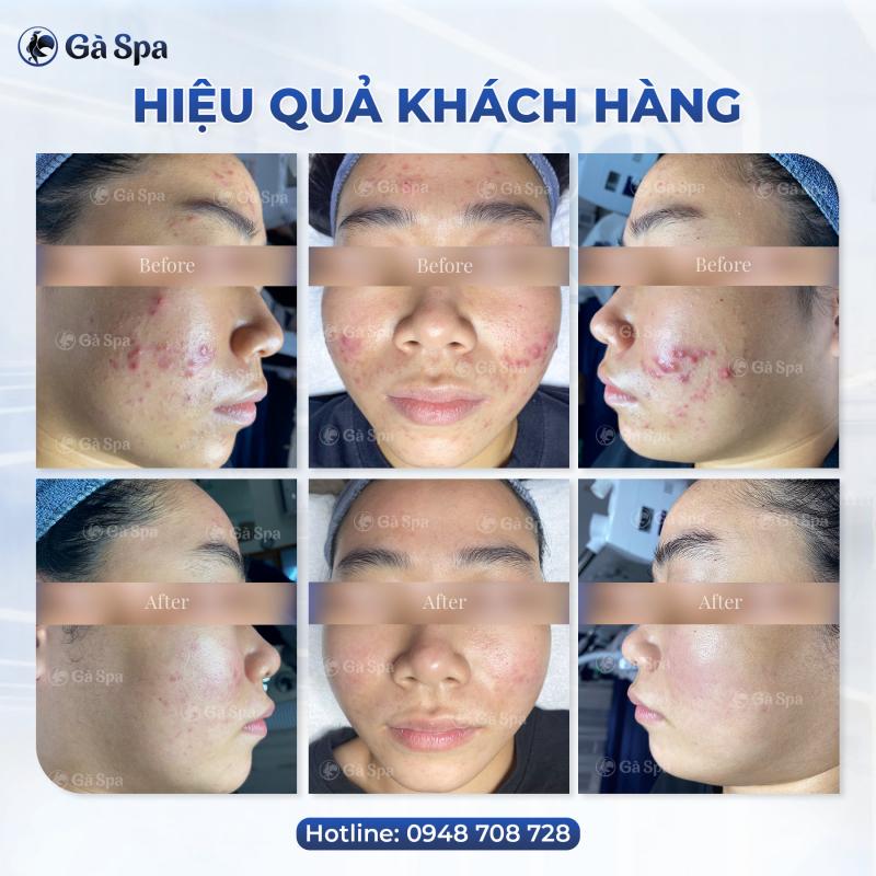 Gà Spa Thủ Đức