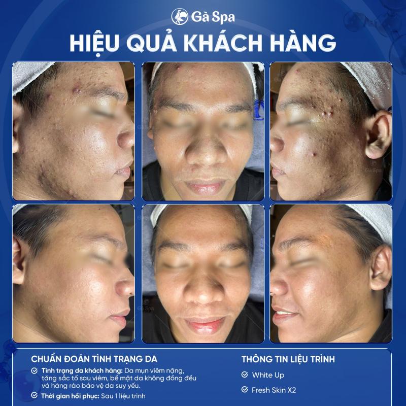 Gà Spa Thủ Đức