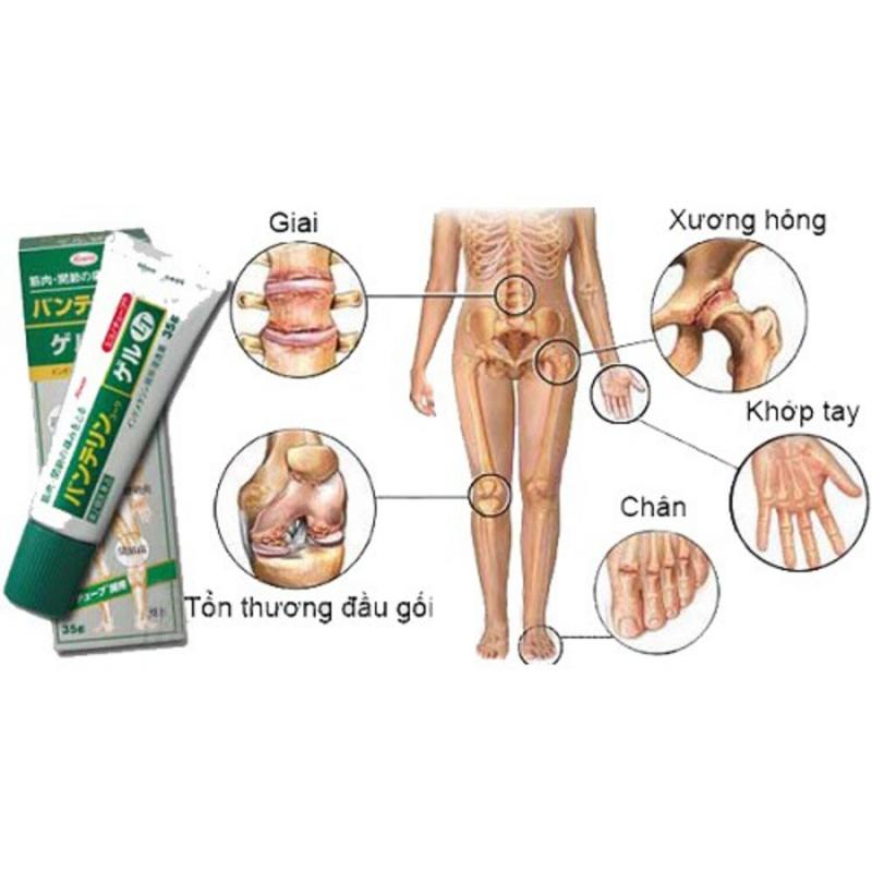 Gel bôi xương khớp Kowa Nhật Bản 60g