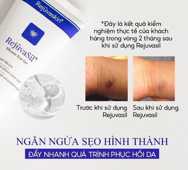 Gel xóa sẹo RejuvaSil