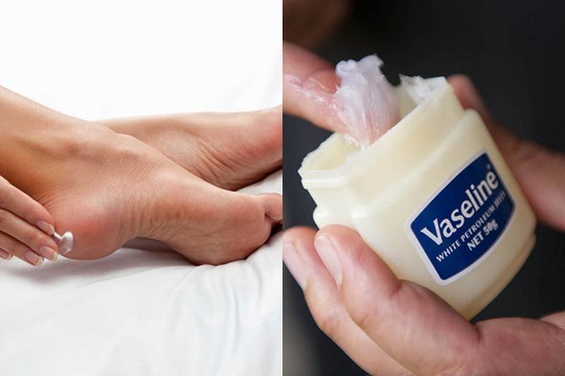 Vaseline trị nứt nẻ gót chân