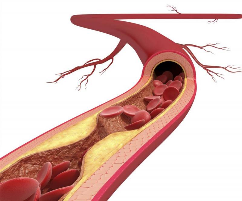 Hạt óc chó làm giảm cholesterol máu, ngăn ngừa xơ vữa động mạch