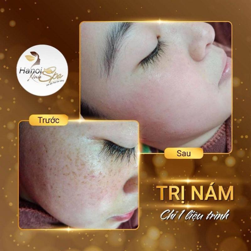 Spa làm đẹp uy tín nhất tại Yên Bái