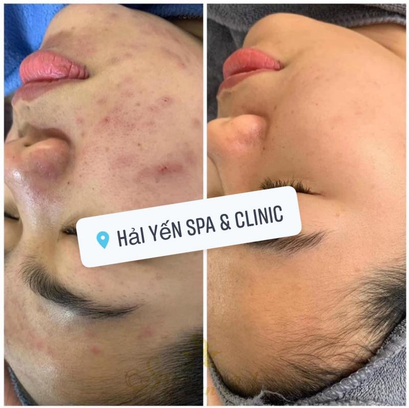 Hải Yến Spa & Clinic