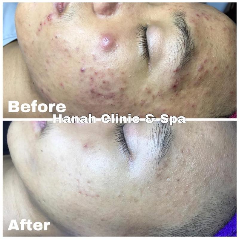 Hanah Clinic - Spa