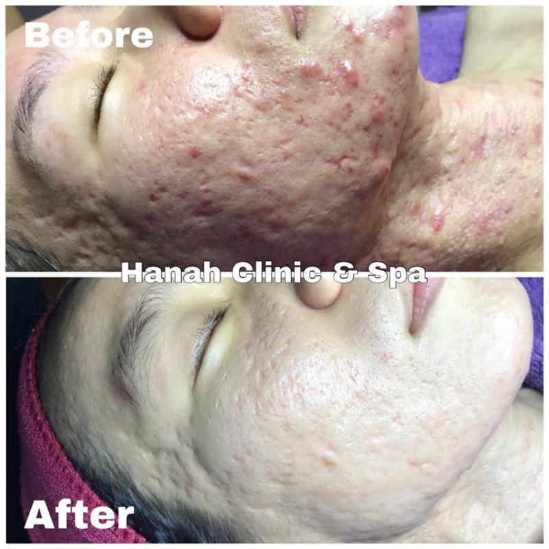 Hanah Clinic - Spa