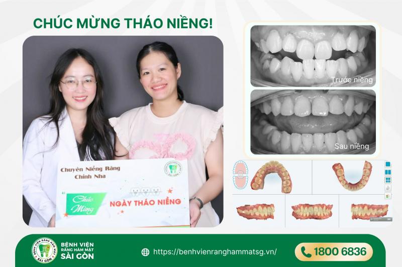 Hệ thống Bệnh viện Răng Hàm Mặt Sài Gòn