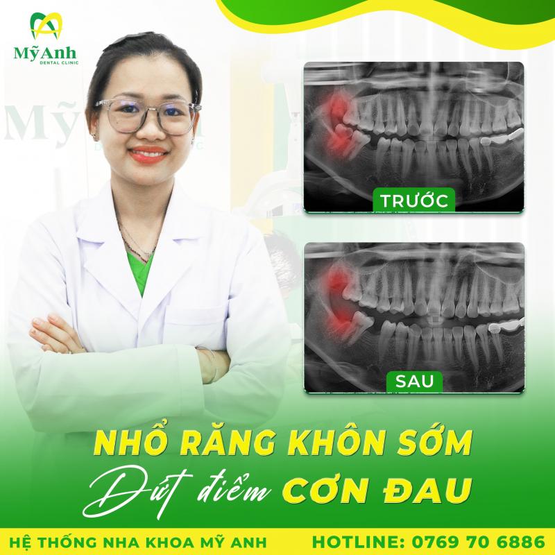 Hệ Thống Nha Khoa Mỹ Anh