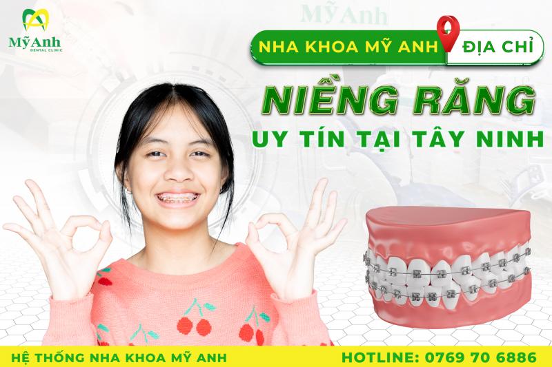 Hệ Thống Nha Khoa Mỹ Anh