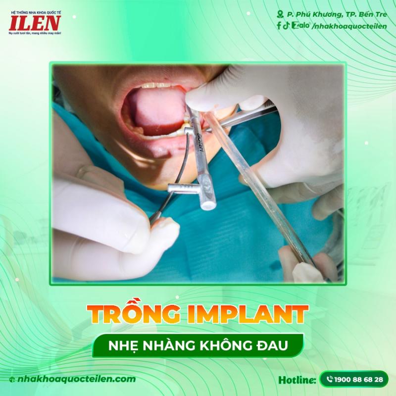 Hệ thống Nha khoa Quốc Tế ILEN