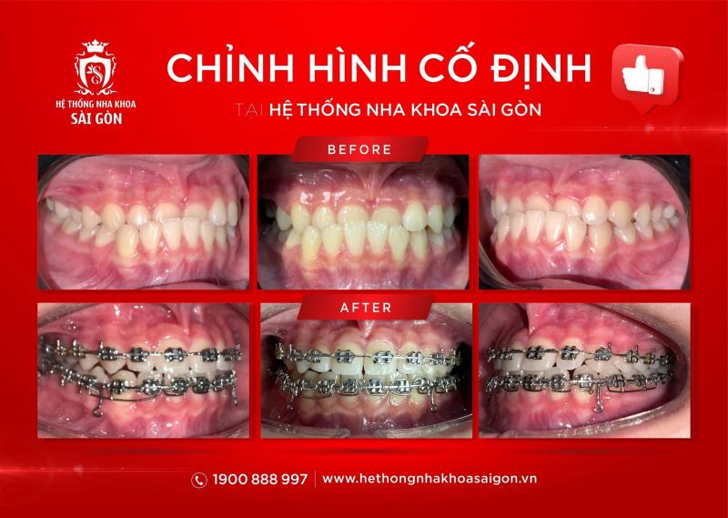 Hệ Thống Nha Khoa Sài Gòn