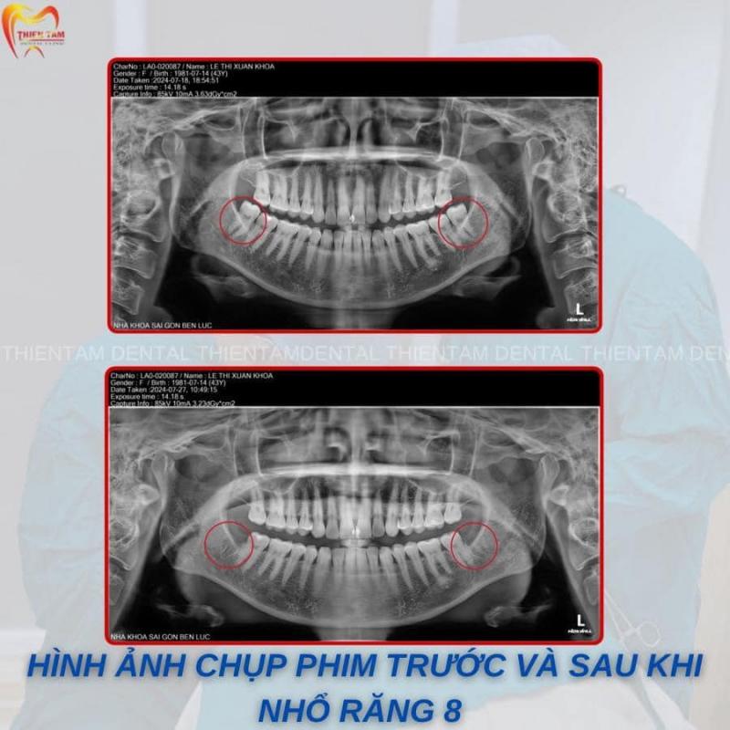 Hệ Thống Nha Khoa Sài Gòn Thiện Tâm