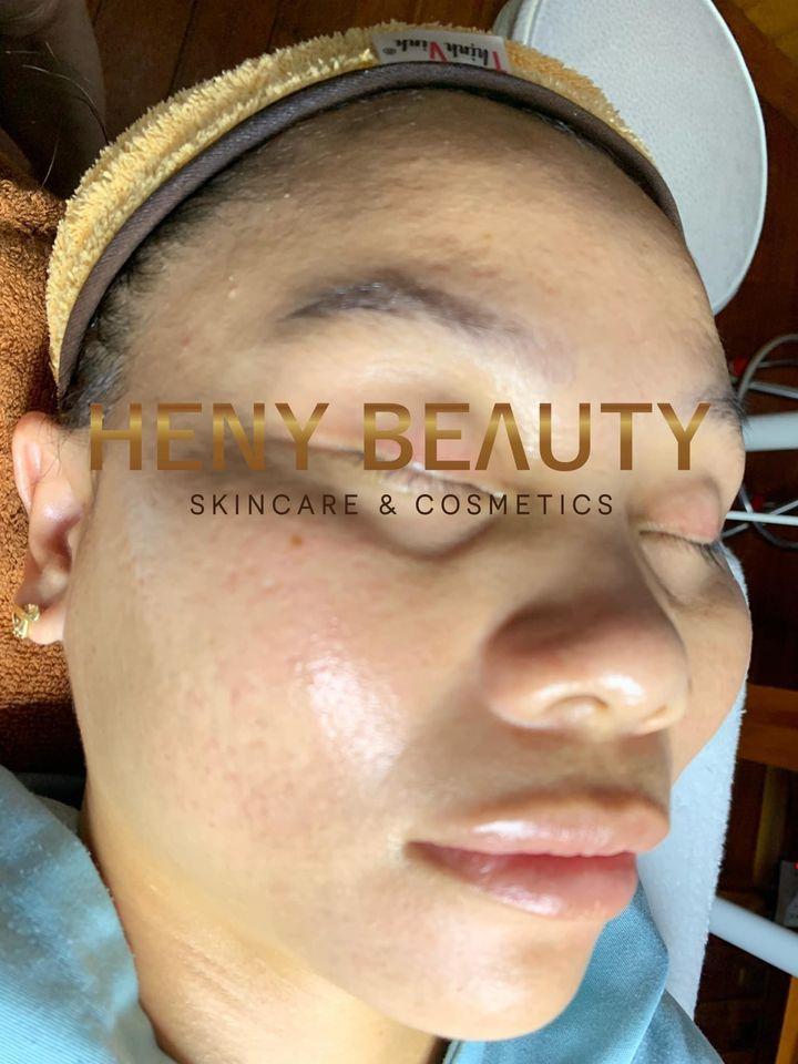 Heny Beauty Gia Lai