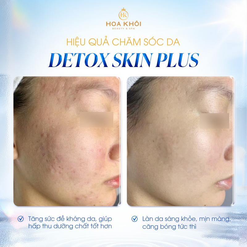Hoa Khôi Beauty & Spa - hơn 10 năm chăm sóc da chuẩn y khoa