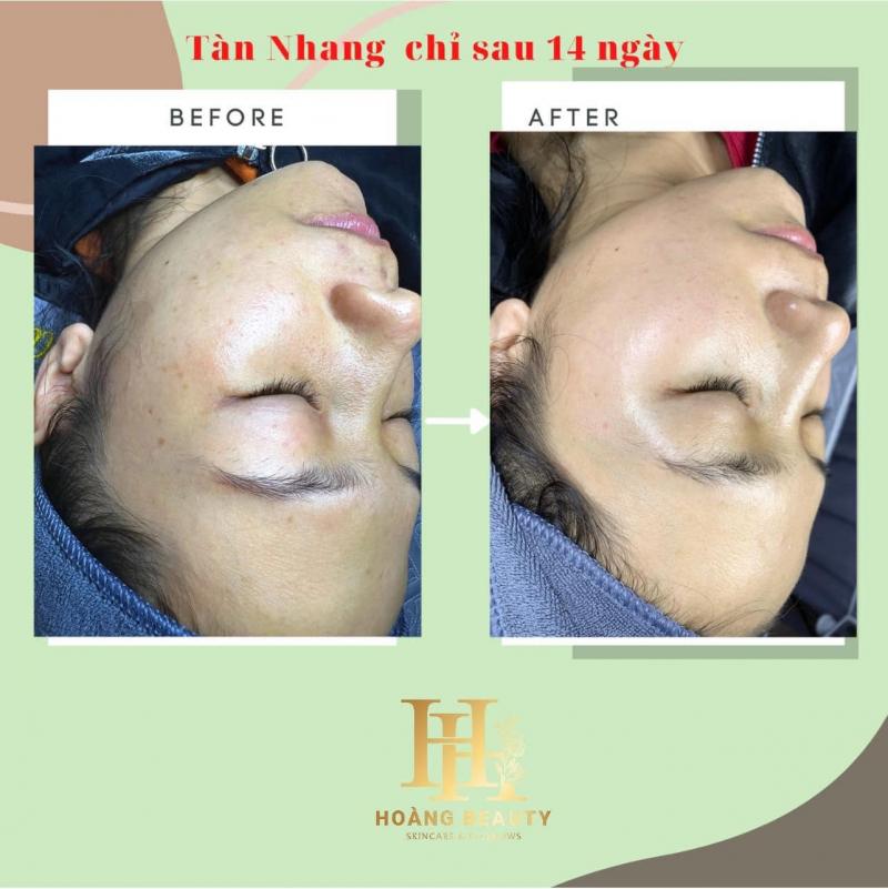 Hoàng Beauty & Spa - Chi Nhánh Quảng Ngãi