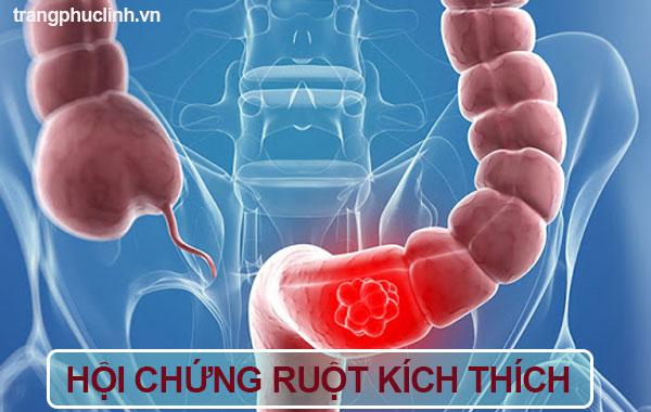 Hội chứng ruột kích thích