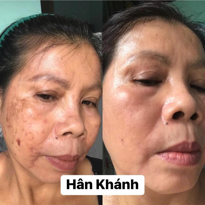 Home Spa Hân Khánh