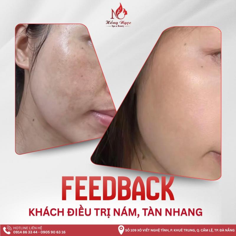 Hồng Ngọc Spa - Spa Trị Nám Hàng Đầu Đà Nẵng