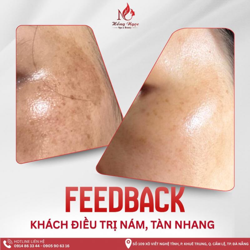 Hồng Ngọc Spa - Spa Trị Nám Hàng Đầu Đà Nẵng