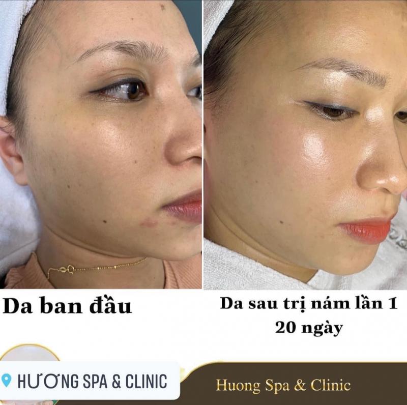 Hương Spa & Clinic