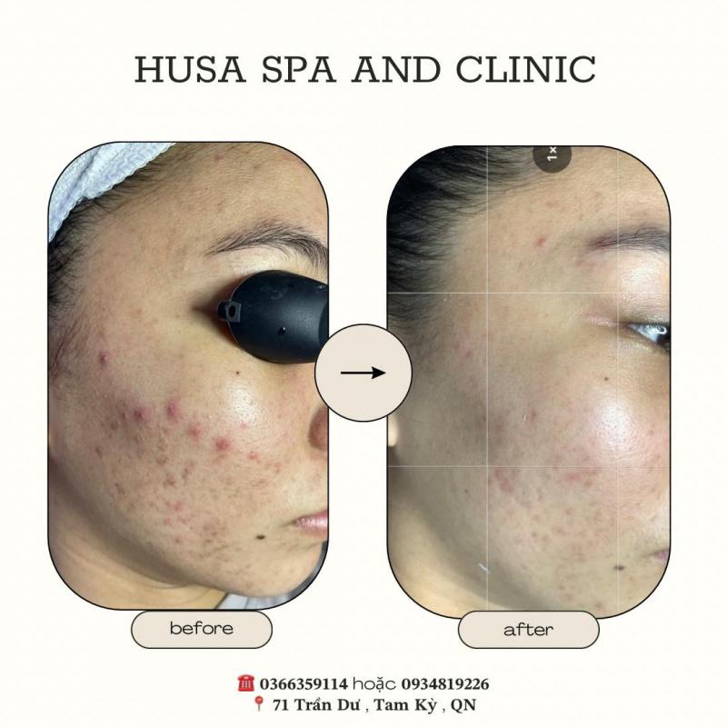 Husa Spa And Clinic