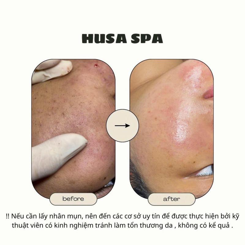 HuSa Spa and Clinic