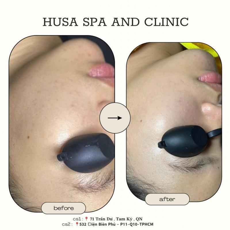 HuSa Spa and Clinic