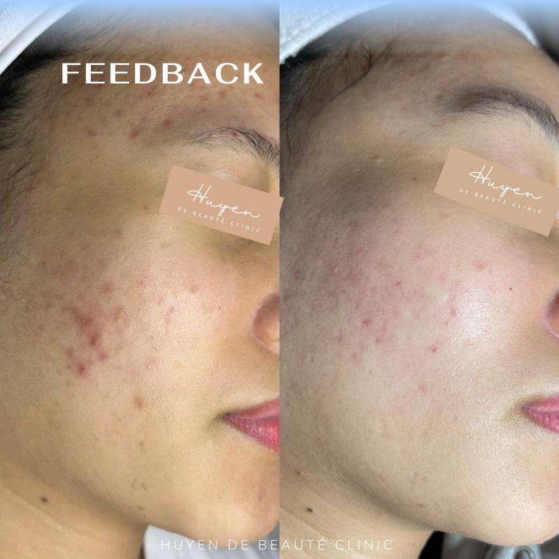 Huyen de Beauté Clinic