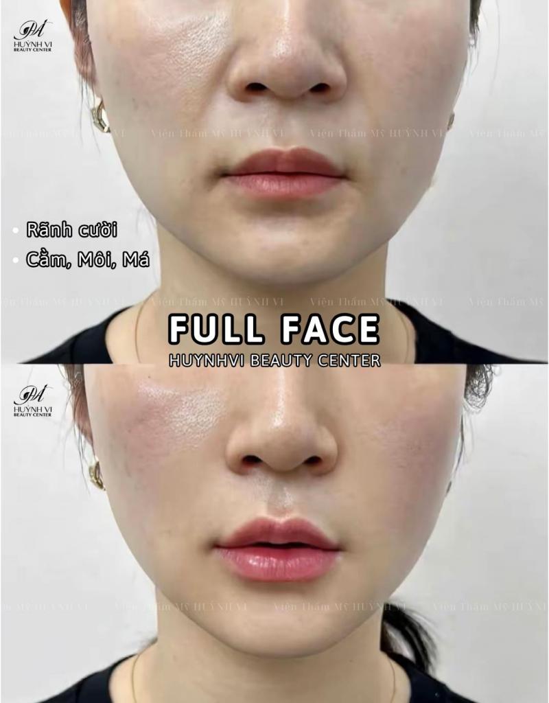 Huỳnh Vi Beauty & Academy