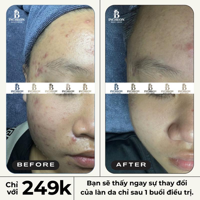 Incheon Beauty