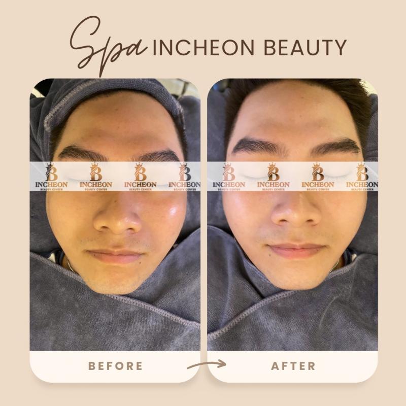 Incheon Beauty