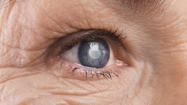 ﻿Izba được chỉ định điều trị bệnh glaucoma