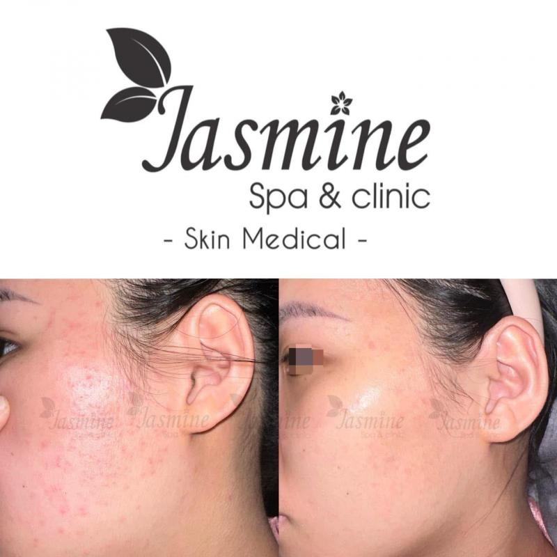 Jasmine Spa & Clinic