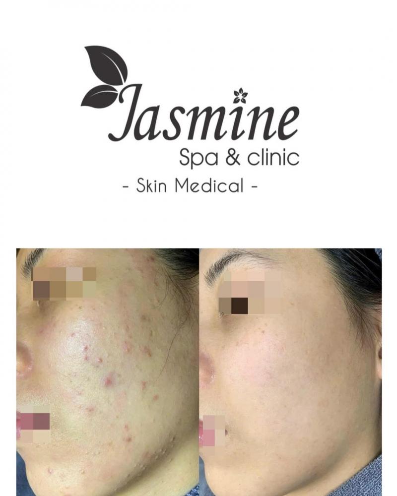 Jasmine Spa & Clinic