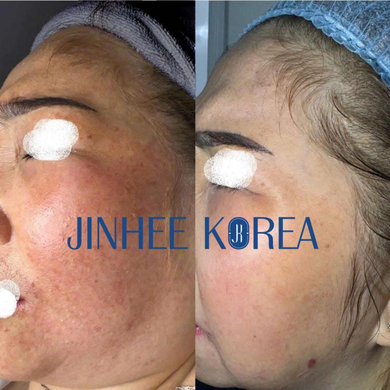 Jinhee Korea spa & clinic