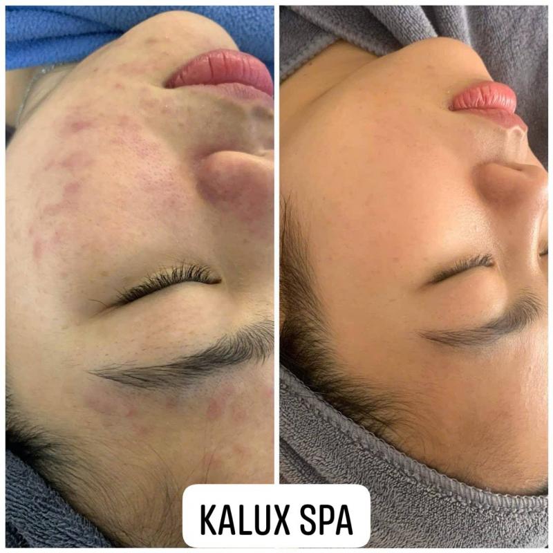 KALUX Beauty Spa
