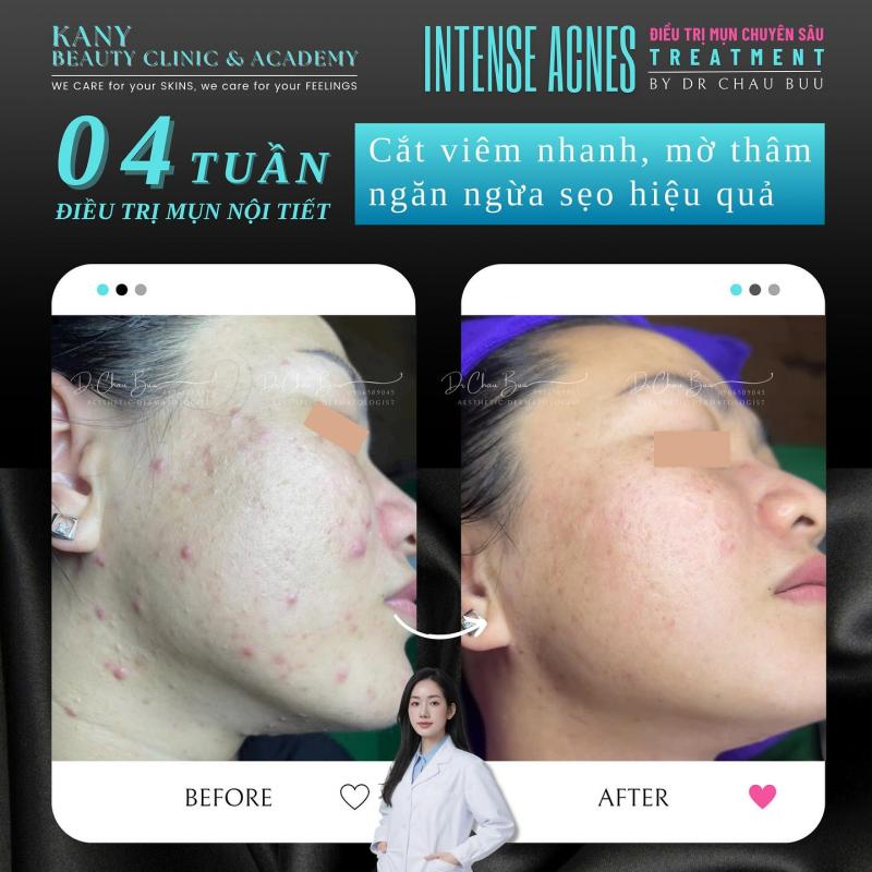 KANY Beauty Clinic & Academy
