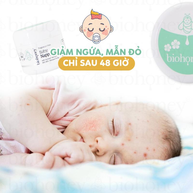 Kem Biohoney Baby Balm