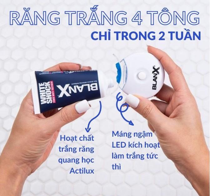 Kem đáng răng trắng răng BlanX White Treatment