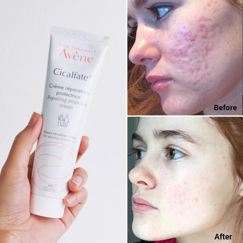 Kem dưỡng Avene Cicalfate Repair Cream