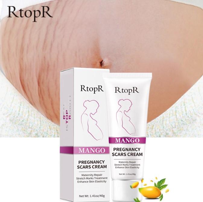 Kem giảm sẹo, rạn da RtopR Mango Pregnancy Scars Cream