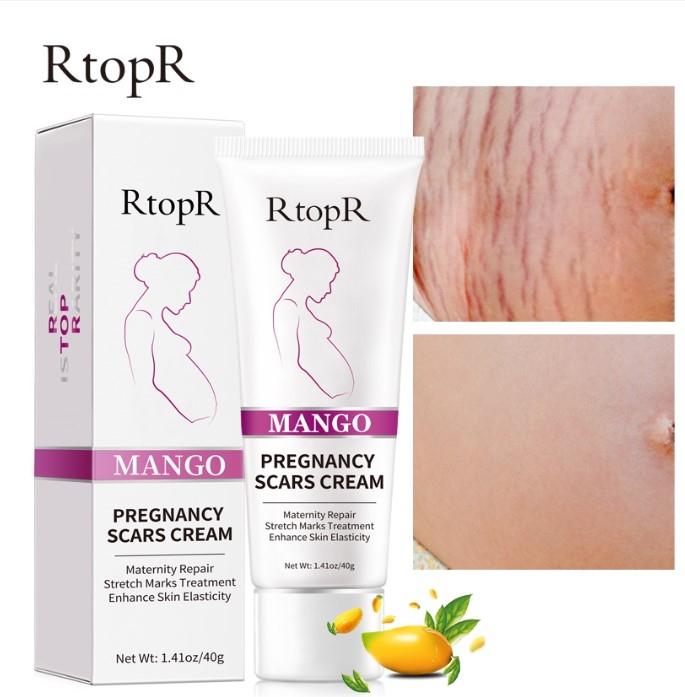 Kem giảm sẹo, rạn da RtopR Mango Pregnancy Scars Cream