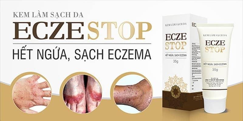 Sản phẩm kem bôi thảo dược Eczestop. ﻿﻿