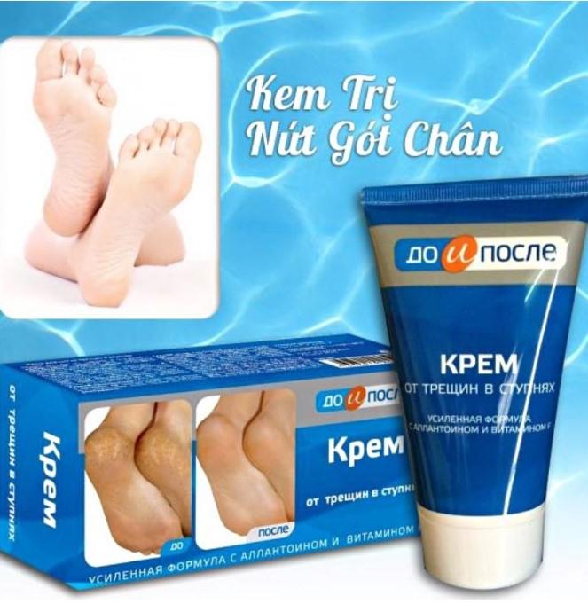 Kem trị nứt gót chân Kpem Apteka