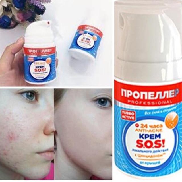 Kem trị sẹo Anti-scar Propeller SOS Cream Russia