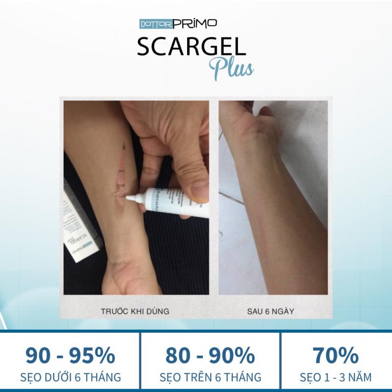 Kem trị sẹo bỏng DottorPrimo Scargel Plus